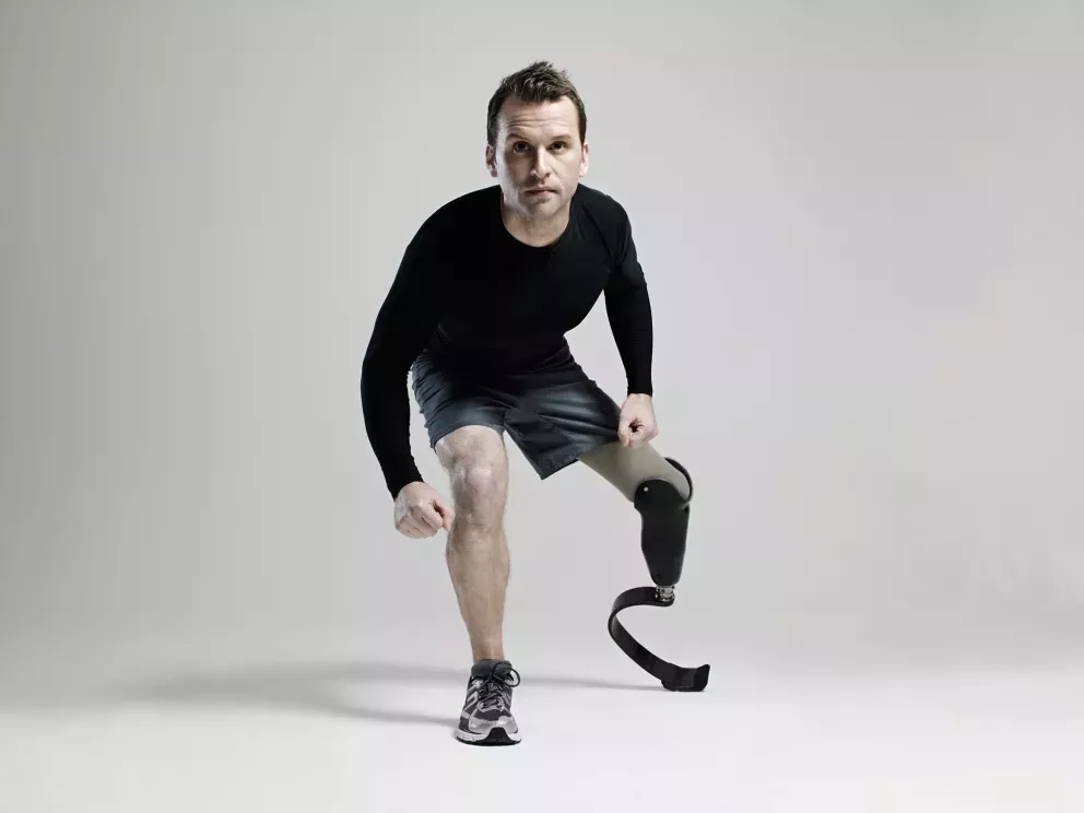 Athlete with prosthetic leg Athlete with prosthetic leg